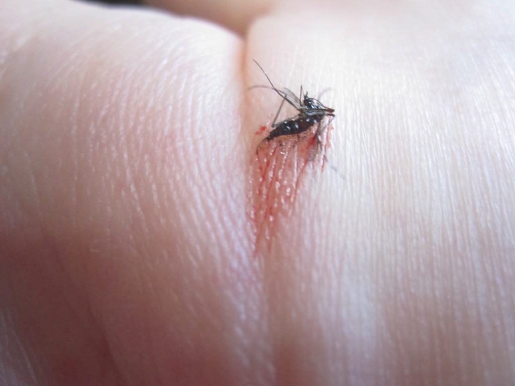 手の平で叩き殺した蚊と吸われた血