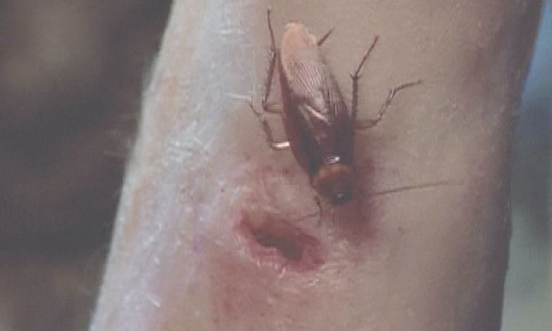 腕の傷口に害虫ワモンゴキブリが忍び寄る